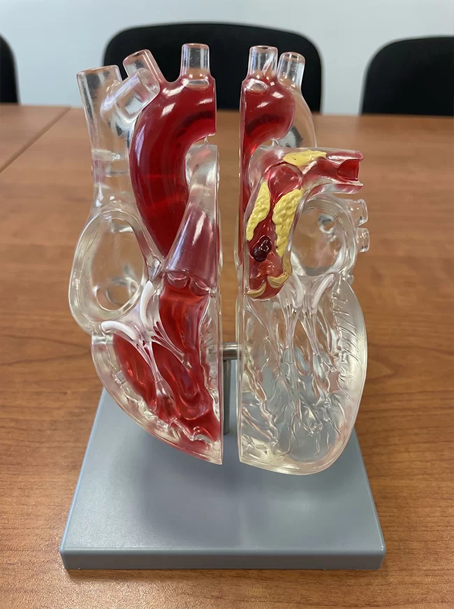 Common Heart Desease
